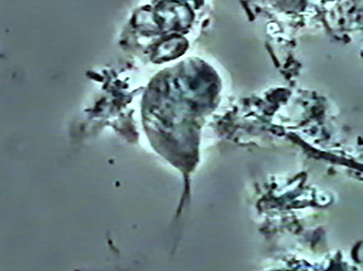 Trichomonas tenax, lo sapevi che... ?
